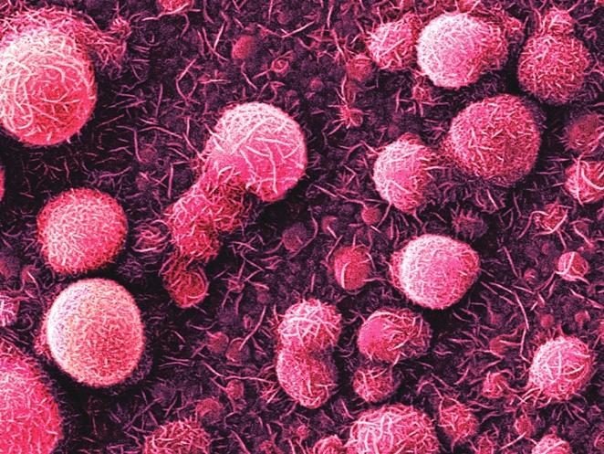 Estructuras de lo Invisible Nanocaramelo. Micrografía con tratamiento digital. Óxido de cinc preparado electroquímicamente con dodecil sulfato de sodio.